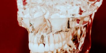 Wenn unerklärliche Beschwerden aus den Tiefen des Kiefers aufsteigen und das System vergiften